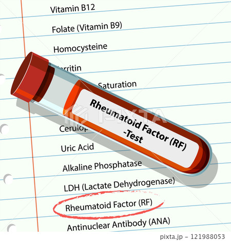 Rheumatoid Factor Blood Test Illustration 121988053