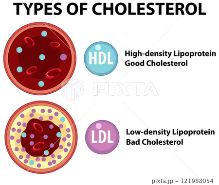 Understanding Types of Cholesterol 121988054