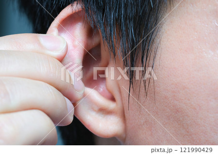 The young man touched his ear and he had a sore ear. 121990429
