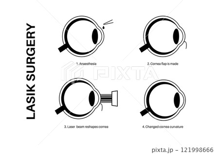 LASIK eye surgery LASIK eye surgery 121998666
