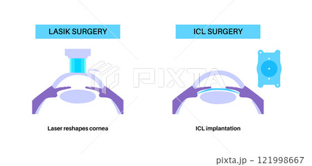 LASIK and ICL EVO 121998667