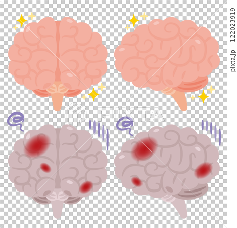 Illustration of a healthy and beautiful brain and an unhealthy brain with inflammation Illustration of a healthy and beautiful brain and an unhealthy brain with inflammation 122023919