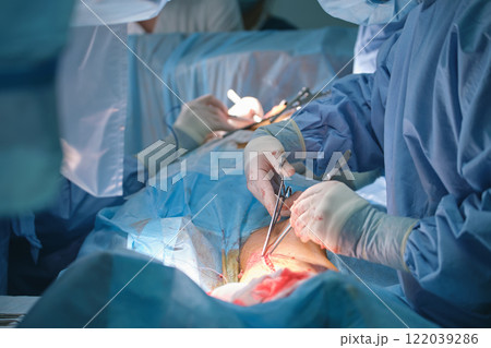Team of professional doctors operating a patient conducting open cut surgery in surgical room. Healthcare and medical intervention concept Team of professional doctors operating a patient conducting open cut surgery in surgical room. Healthcare and medical intervention concept 122039286