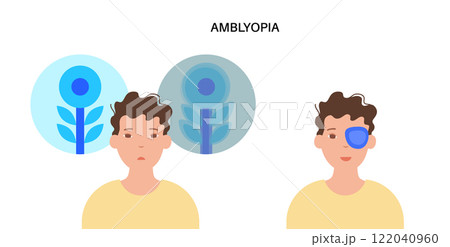 Amblyopia or lazy eye 122040960