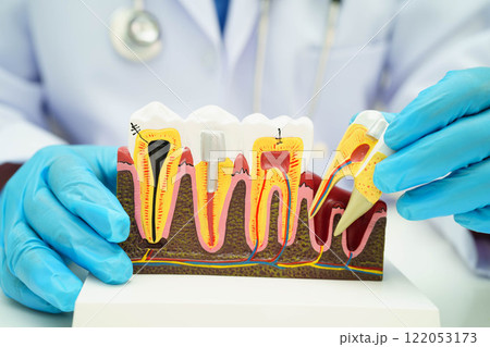 Dentist holding dental implant, artificial tooth roots into jaw, root canal of dental treatment, gum disease, teeth model for dentist. Dentist holding dental implant, artificial tooth roots into jaw, root canal of dental treatment, gum disease, teeth model for dentist. 122053173