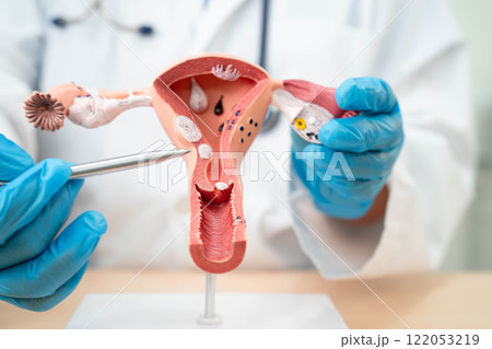 Uterus, doctor holding human anatomy model for study diagnosis and treatment in hospital. Uterus, doctor holding human anatomy model for study diagnosis and treatment in hospital. 122053219