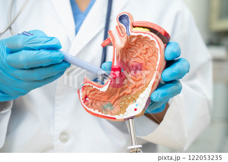 Stomach disease, doctor holding anatomy model for study diagnosis and treatment in hospital. 122053235