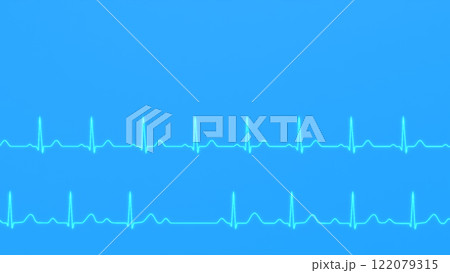 Comparison of ECG of normal heart rhythm and AV block 2nd degree Comparison of ECG of normal heart rhythm and AV block 2nd degree 122079315