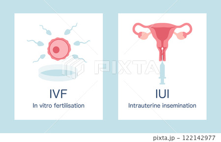 In vitro fertilization IVF and intrauterine insemination IUI infographic posters set. Egg, sperm, uterus and syringe illustration in cartoon flat style. Vector illustration 122142977