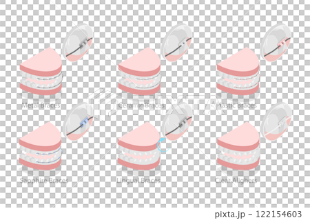 3D Isometric Flat  Illustration of Dental Teeth Braces Types, Orthodontic Options for Teeth Straightening 122154603