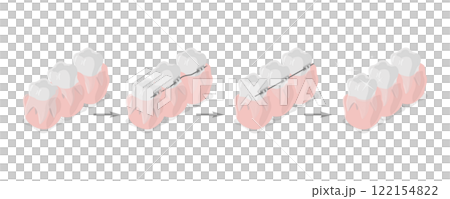 3D Isometric Flat  Illustration of Dental Teeth Braces, Orthodontic Care 122154822