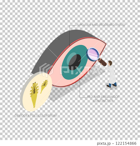3D Isometric Flat  Illustration of Demodex Folliculorum, Demodicosis Affecting the Eyelid and Causing Red Eyes 122154866