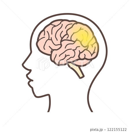 レビー小体型認知症を表現した脳のイラスト レビー小体型認知症を表現した脳のイラスト 122155122