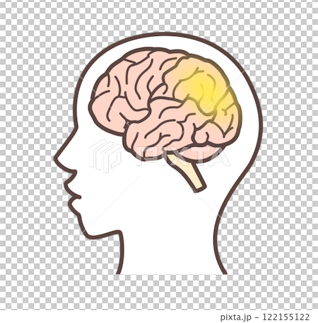 レビー小体型認知症を表現した脳のイラスト レビー小体型認知症を表現した脳のイラスト 122155122