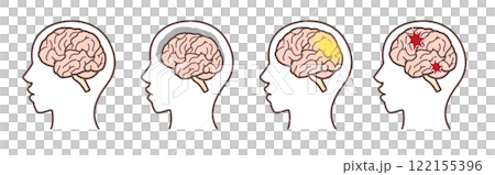 大腦插圖集 122155396