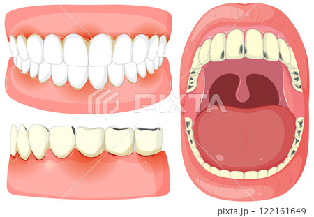 Dental Anatomy and Oral Health Illustration 122161649