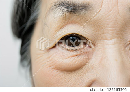 皺・たるみ・しみに悩むおばあさん（眼瞼下垂・目の下のふくらみ・整形・若返り）	 122165503