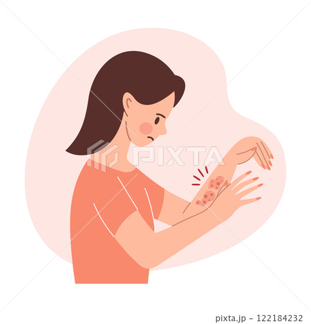 Woman with itchy skin rash. Allergic itching, skin inflammation, redness and irritation. Healthcare and medicine. 122184232