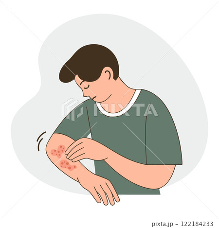 Man with itchy skin rash. Allergic itching, skin inflammation, redness and irritation. Healthcare and medicine. 122184233