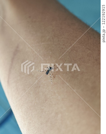 Aedes Mosquito on Human Skin Close-up 122192915