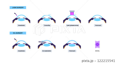LASIK and ICL EVO 122215541