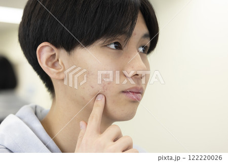 肌荒れを気にする男子学生 肌荒れを気にする男子学生 122220026