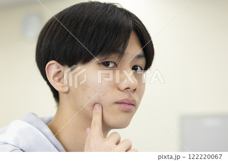 肌荒れを気にする男子学生 122220067