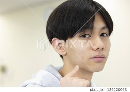 肌荒れを気にする男子学生 122220068