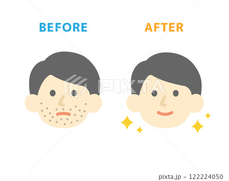 ヒゲ脱毛の、ビフォーアフターのアイコンのイラスト 122224050