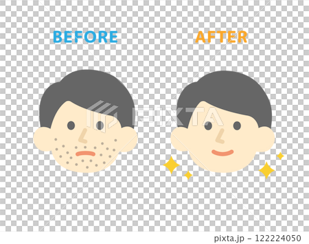 Beard hair removal, before and after icon illustration Beard hair removal, before and after icon illustration 122224050