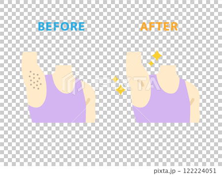 ワキ脱毛の、ビフォーアフターのアイコンのイラスト 122224051