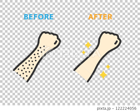 Arm hair removal, before and after icon (line drawing color) illustration Arm hair removal, before and after icon (line drawing color) illustration 122224056