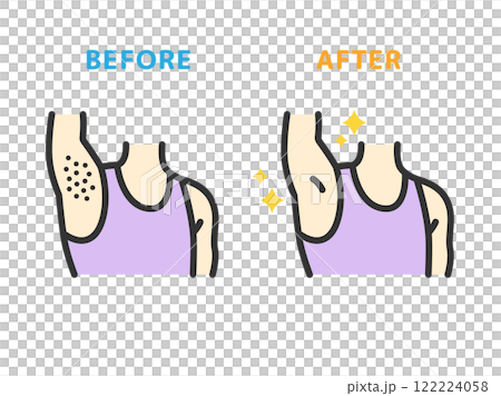 腋下除毛前後圖示（線條顏色）插圖 122224058