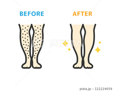 足脱毛の、ビフォーアフターのアイコン(線画カラー)のイラスト 足脱毛の、ビフォーアフターのアイコン(線画カラー)のイラスト 122224059
