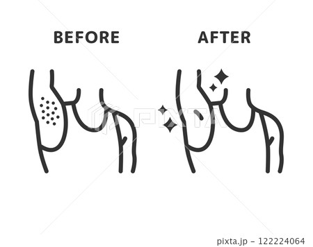 ワキ脱毛の、ビフォーアフターのアイコン（線画）のイラスト 122224064