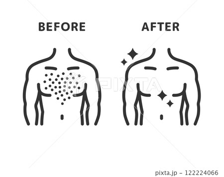 胸毛脱毛の、ビフォーアフターのアイコン(線画)のイラスト 胸毛脱毛の、ビフォーアフターのアイコン(線画)のイラスト 122224066