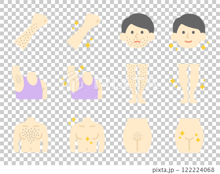 Illustration of before and after hair removal icons for various parts of the body 122224068