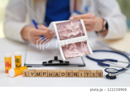 Overview of lymphadenitis diagnosis, treatment protocols, examination methods, and therapies Overview of lymphadenitis diagnosis, treatment protocols, examination methods, and therapies 122238908