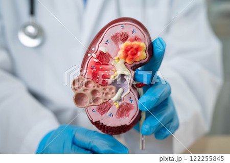 Chronic kidney disease, doctor with model for treatment urinary system, urology, Estimated glomerular filtration rate eGFR. 122255845