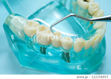 Teeth dental model with tool for dentist use to cleaning care treatment. 122256857