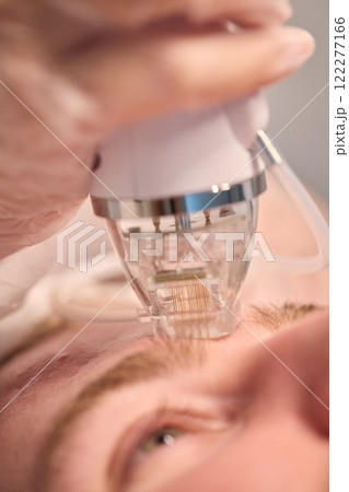 A man is currently undergoing a specialized facial treatment within a serene spa setting 122277166