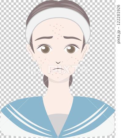 Junior and senior high school girls suffering from acne Junior and senior high school girls suffering from acne 122281926