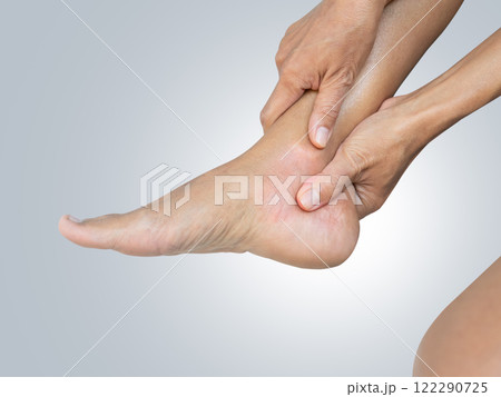 Sore ankle Pain Foot Woman, Sprain Feet Heel Knee Sore People Chronic Joint Leg Hurt Injury Bone Arthritis Skeleton Girl Accident Fitness Sport Exercise Medical Care Treatment Massage,Osteoarthritis 122290725