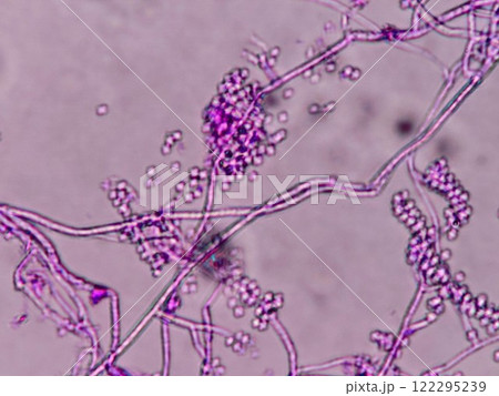 白カビの顕微鏡写真 122295239