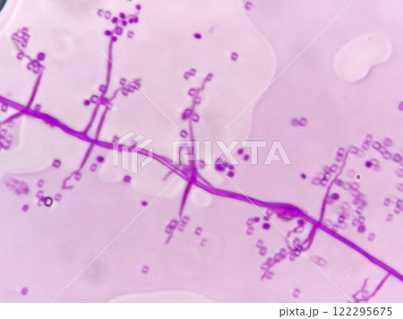 きれいに枝分かれしたカビの菌糸 きれいに枝分かれしたカビの菌糸 122295675