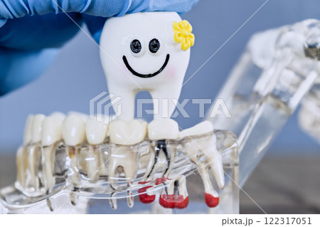 Playful Dental Implant Model Featuring a Smiling Tooth Character with a Gloved Hand Demonstration 122317051