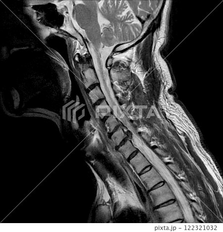 頭部 診断 診察 122321032