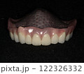 義歯 122326332