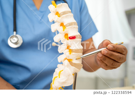 Doctor with lumbar vertebra bone skeleton and nerve model for treatment in the orthopedic department. Doctor with lumbar vertebra bone skeleton and nerve model for treatment in the orthopedic department. 122338594
