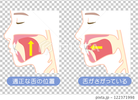 Correct and lowered tongue position - Mewing 122371998